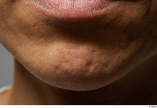  HD Face skin references Chikanari Ryosei lips mouth scar skin pores skin texture 0002.jpg